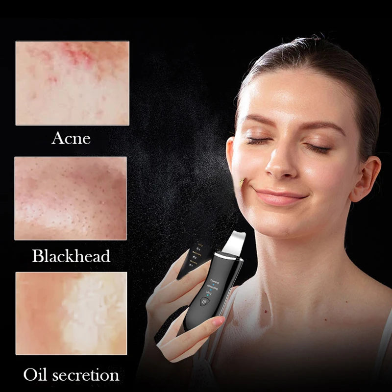 Mini Ultrasonic Facial Skin Scrubber Cleaner Ion Acne Blackhead Remover Peeling Shovel Beauty Facial Massager Skin Care Tools